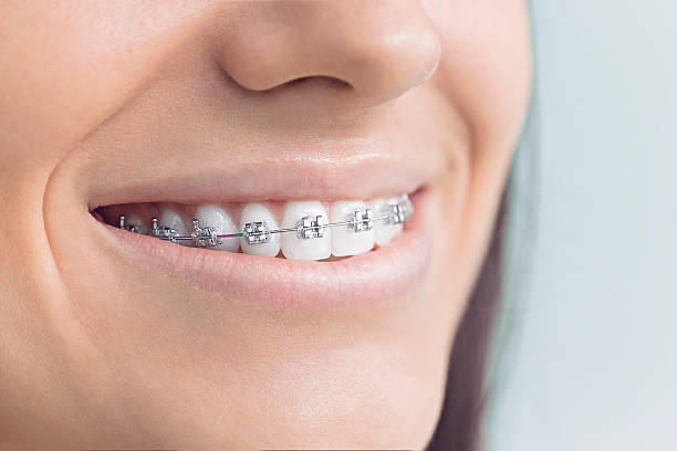 Best Dental Inlays and Onlays  in Amarillo, TX